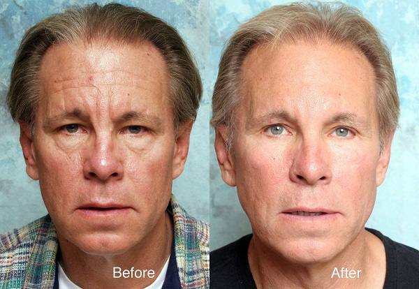 13 Ways To Look Younger Naturally Without Makeup or Surgery