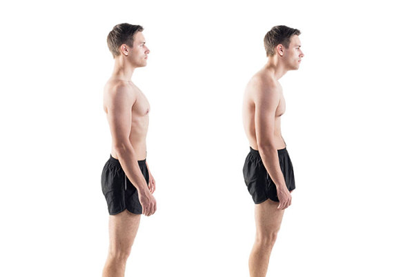 fix rounded shoulders posture